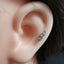 JRTH38 SURGICAL HELIX AAB CO..